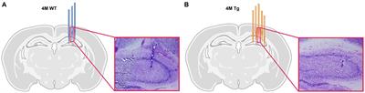 Alterations in theta-gamma coupling and sharp wave-ripple, signs of prodromal hippocampal network impairment in the TgF344-AD rat model
